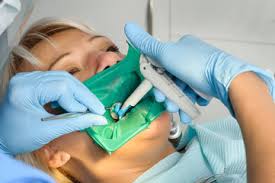 mercury filling removal dentist