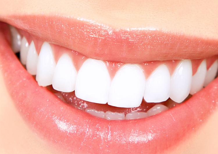 Teeth whitening Before and after